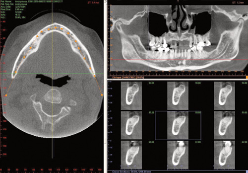 CT Dental Scan