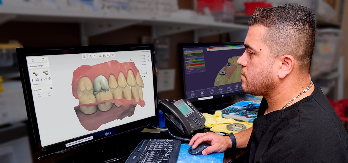 Naples Dental Lab CAD Software