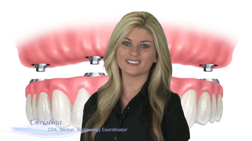 Dental Implants to Replace Missing Teeth