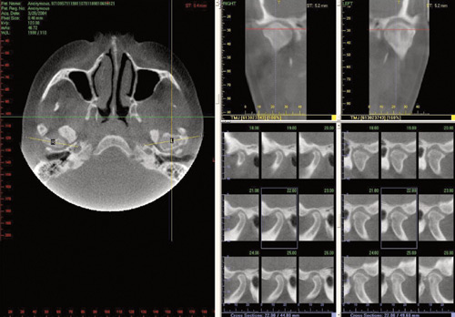 Dental CT 
  Scan