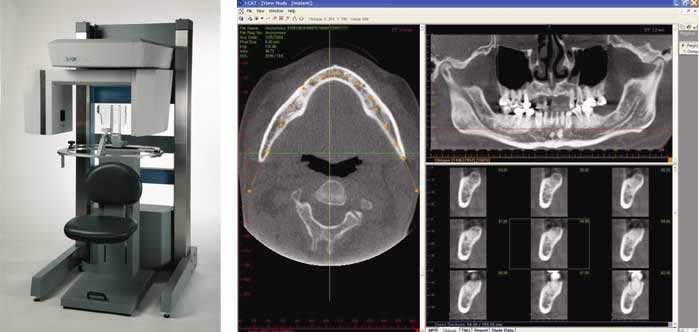 In-office dental CT scan